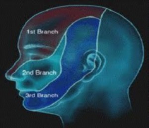 Trigeminal neuralgia
